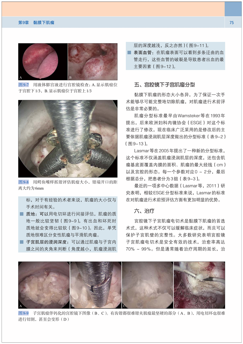 正版 协和宫腔镜下的世界从解剖到病理 宫腔镜手术宫腔镜诊断治疗技术宫腔镜学宫腔镜诊断图谱 妇产科临床医学教材97875679096