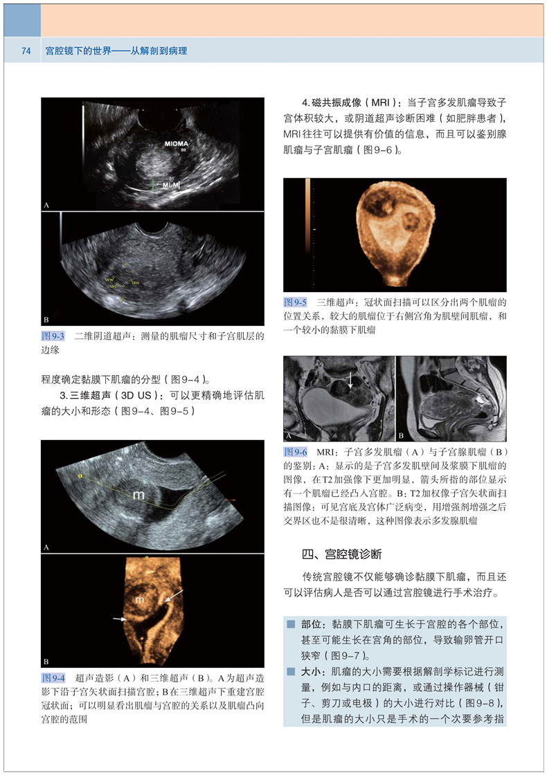 正版 协和宫腔镜下的世界从解剖到病理 宫腔镜手术宫腔镜诊断治疗技术宫腔镜学宫腔镜诊断图谱 妇产科临床医学教材97875679096