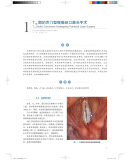 《喉癌：临床病例精要》([巴西] 罗杰里奥·德迪迪蒂斯 等 著) 喉癌的病例分析 喉癌的临床表现有哪些 喉癌病例 简述喉癌的临床表现