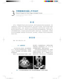 《喉癌：临床病例精要》([巴西] 罗杰里奥·德迪迪蒂斯 等 著) 喉癌的病例分析 喉癌的临床表现有哪些 喉癌病例 简述喉癌的临床表现