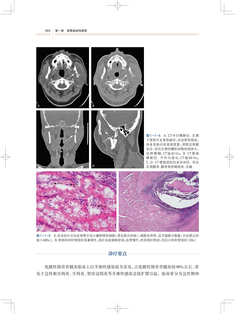 《颅颌面骨感染与肿瘤性疾病:诊断和治疗》（何悦 编） 颅颌面骨感染与肿瘤性疾病:诊断和治疗方案