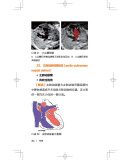 《产前超声掌中宝》（邓学东 著）--产前超声掌中宝邓学东 邓学东胎儿超声口诀 产前超声掌中宝书邓学东主编 邓学东超声 助产士专业书籍