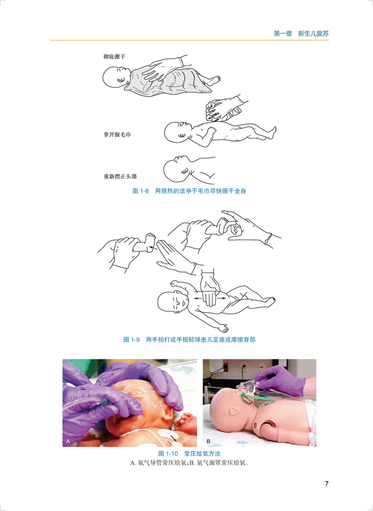《新生儿治疗技术》