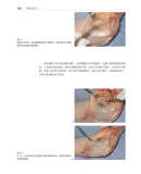 软组织手术 史蒂文 L.莫兰 M.D. 著 李正维 译 9787538198911 辽宁科学技术出版社