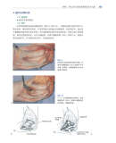 软组织手术 史蒂文 L.莫兰 M.D. 著 李正维 译 9787538198911 辽宁科学技术出版社