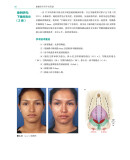 《鼻整形外科手术图谱》（[美] 罗林·K.丹尼尔 著）辽宁科学技术出版社