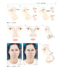 《鼻整形外科手术图谱》（[美] 罗林·K.丹尼尔 著）辽宁科学技术出版社