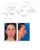 《鼻整形外科手术图谱》（[美] 罗林·K.丹尼尔 著）辽宁科学技术出版社