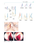 《鼻整形外科手术图谱》（[美] 罗林·K.丹尼尔 著）辽宁科学技术出版社