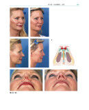 《鼻整形外科手术图谱》（[美] 罗林·K.丹尼尔 著）辽宁科学技术出版社