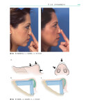 《鼻整形外科手术图谱》（[美] 罗林·K.丹尼尔 著）辽宁科学技术出版社